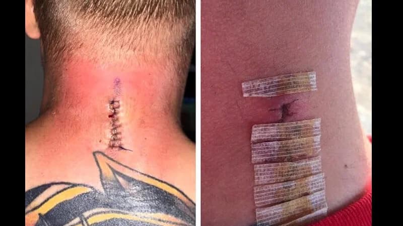 TERROR: Scott Vogel muss zuhause bleiben!