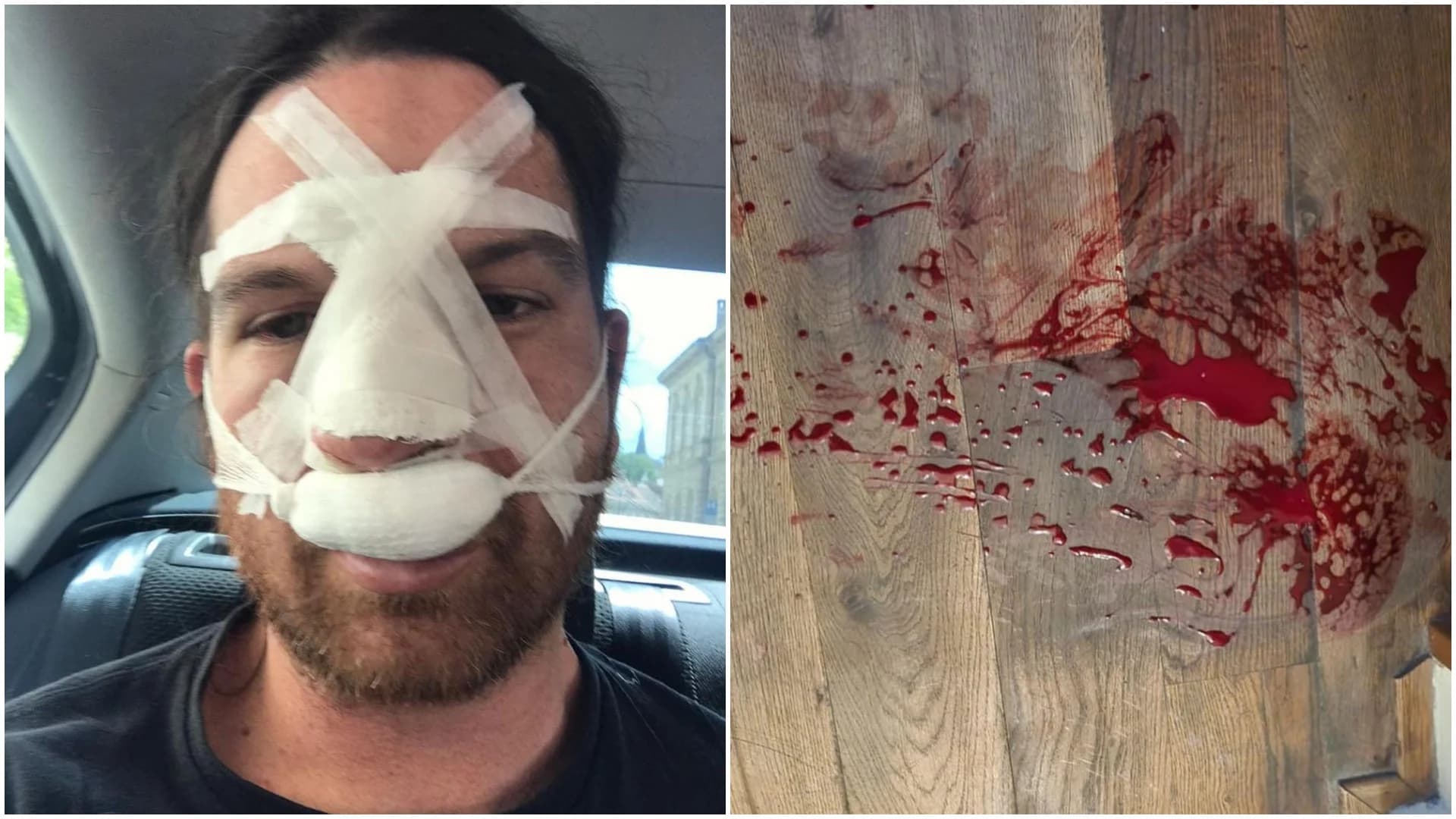 Nach brutaler Gewalt gegen Drummer: Vulvodynia werfen Sänger Duncan Bentley aus der Band